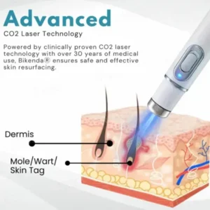 Bikenda® Non-Invasive Mole and Wart Removal Laser Pen